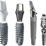 dental-implants