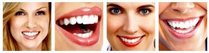 People teeth collage.