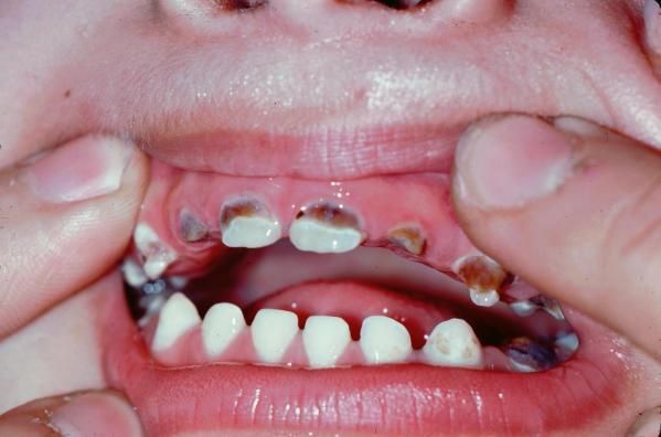 dental_597b5bd76114e_pormatlab.com