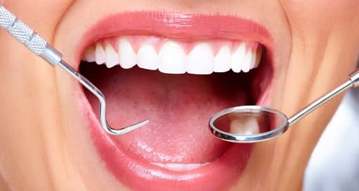 اینله و اُنله از روش‌های دندانپزشکی زیبایی در اصفهان